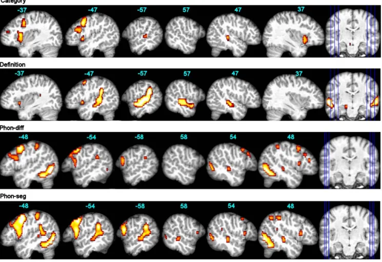 Fig. 1. fMRI group effects for each language task. Results are displayed at p&lt;0.05 FWE-corr