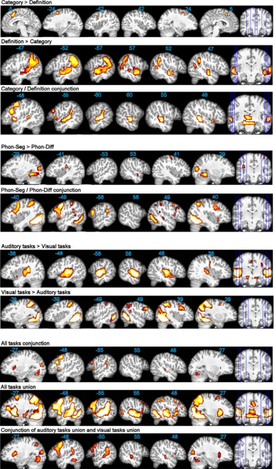 Fig. 2. Task comparisons, conjunctions, and union (p<0.001 unc.). Functional maps are superimposed onto an  individual brain normalized with respect to our customized pediatric template, with x-coordinates in MNI space