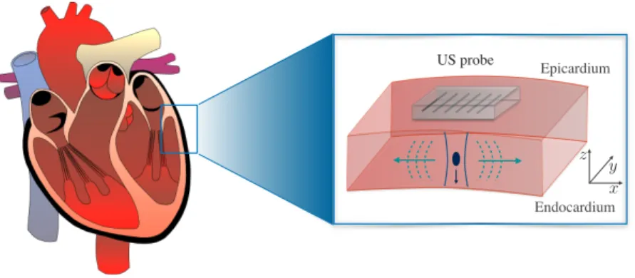 Figure 1: Schematic description of shear wave generation.