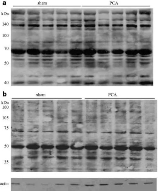 Fig 2. Detection of HNE-linked proteins in arterial plasma (a) and frontal cortex (b) from PCA and sham-operated  control rats 