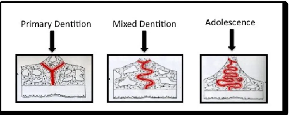 Figure 11. Increased Palatal Interdigitations with Age. Adapted from Proffit. 45 2.3.7 Treatment in Adults 