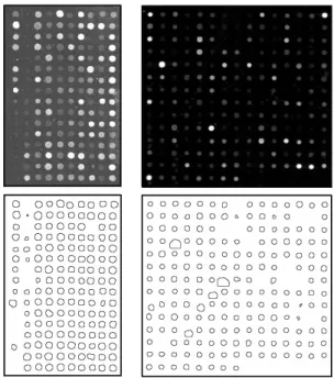 Fig. 8. Two examples of spot segmentation using the present polar GMP algorithm: Top, original microarrays (for visualisation purposes, the intensity has been modified by a gamma function γ = 2).