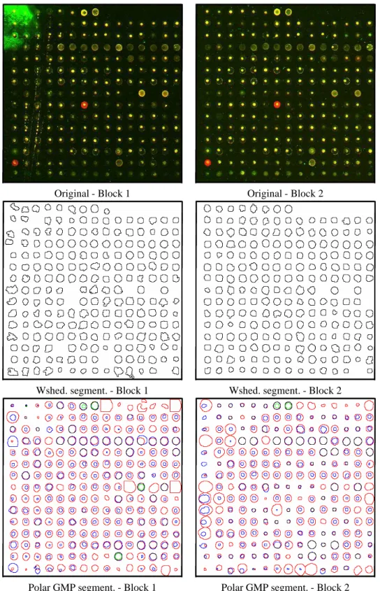 Fig. 9. Comparison of spot segmentation on replicated blocks (the same DNA probes on each spot from two different microarray images): Top, original blocks of spots (for visualisation purposes, the intensity has been multiplied by 10); middle left, segmenta