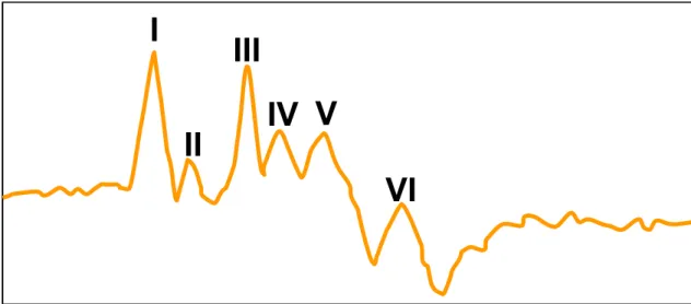 Figure 4 : Tracé de PAE chez un poulain normal. On note la présence de 6 ondes. 