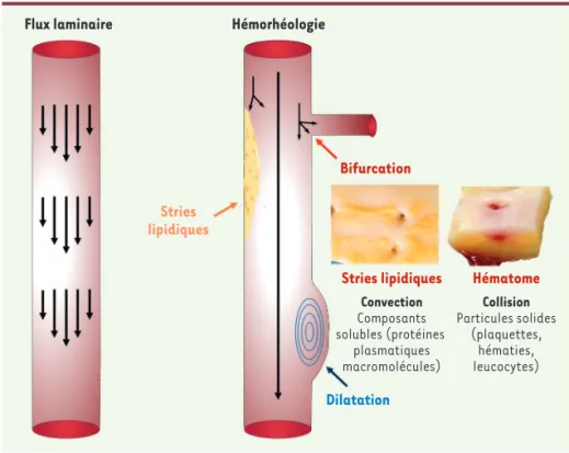 Figure 2.  Collision des cellules circulantes  avec la paroi et conséquences pathologiques.