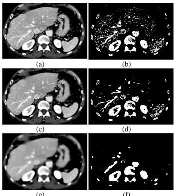 Fig.  3.  Exemple  de  filtrage  FLC f,k      (c,  d)  sur  des  images  bruitées  en niveaux  de  gris  (à  gauche)  et  binaires  (à  droite)  (a, b) par rapport à un filtrage médian (e,f) de même taille