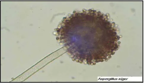 Figure 03: La structure d'Aspergillus niger (Kiran, 2016). 