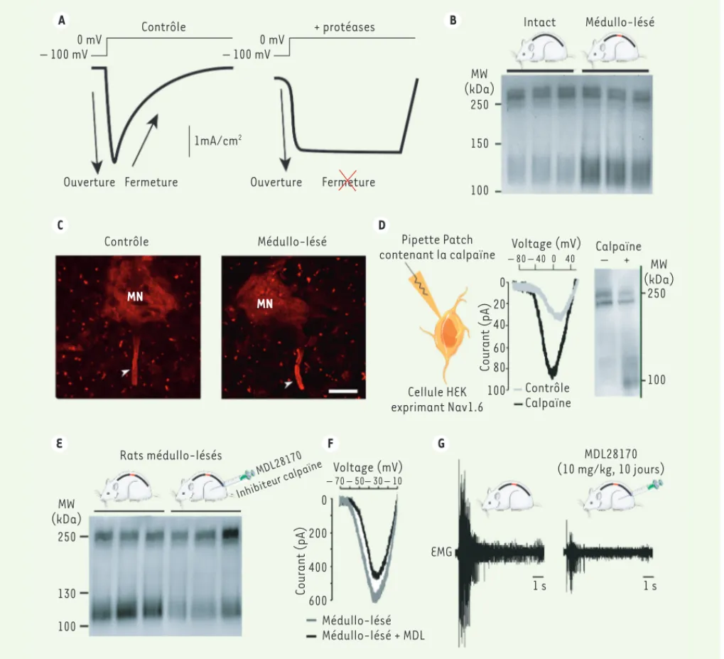 Figure 4. Le clivage des canaux sodiques augmente le courant sodique persistant (I NaP ) des motoneurones et contribue au développement des  spasmes chez les rats médullo-lésés