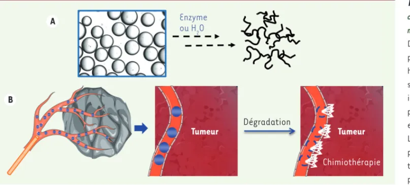 Figure 1. Principe de la  chimio-embolisation avec des  microsphères dégradables. A. 