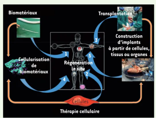 Figure 1. Trois stratégies principales utilisables pour la réparation de tissus ou  d’organes