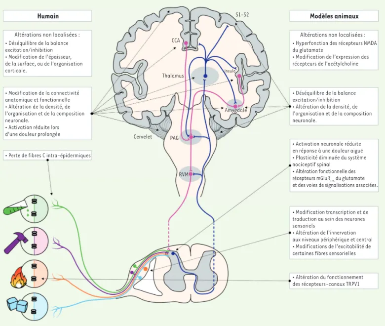 Figure 1. Les particularités de la sensibilité nociceptive dans l’autisme : hypothèses cellulaires et moléculaires