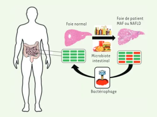 Figure 1. La phagothérapie pour éradiquer des bactéries intestinales impliquées dans les mala- mala-dies nutritionnelles hépatiques
