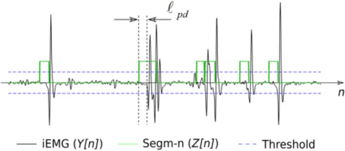 Fig. 2: Example of iEMG segmentation. Segments are detected using certain threshold and shifted in time to the left by l pd due to the use of future samples