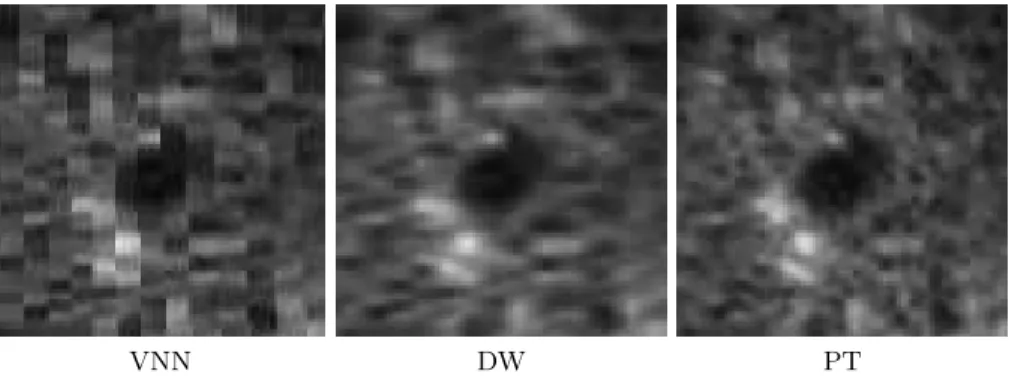Fig. 5. Zoom on hepatic vessels extracted from liver reconstruction with degree= 1 and subsampling factor= 4