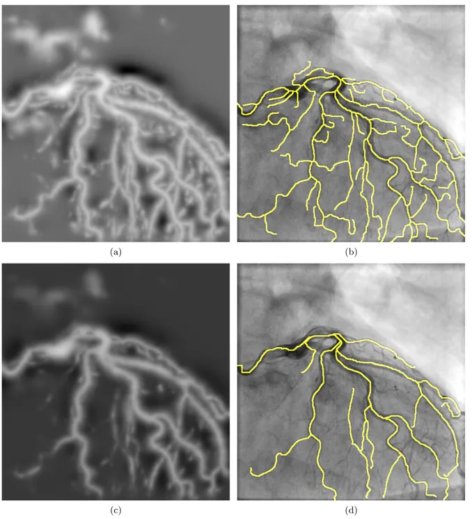 Figure 3. Eﬀect of changing the smoothing weight on Coronary Image for the medialness and the centerline