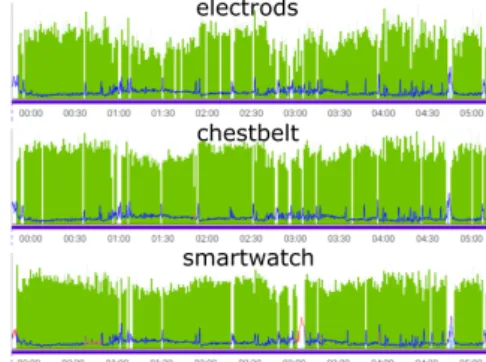 Figure 1: HR (blue line) and HRV (green area) from electrodes, chestbelt  and smartwatch wear during the same night