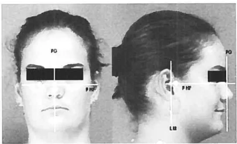 Figure 5: Plans de repère pour les différentes mesures crmniennes et faciales. PG: