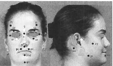 Figure 6: Repères osseux caractérisant le crâne et la face. imd: point d’inflexion mandibulaire; ec: