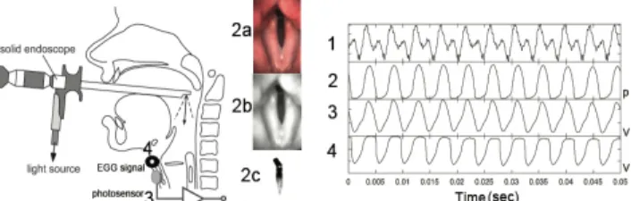Fig. 2: Setup to acquire simultaneously (1) Acoustic signal in  Volts,  (2)  images  from  high-speed  video-endoscopy  (4000  images/s):  (2a)  Original  image,  (2b)  Filtered  image,  (2c)  Detected GA and (2), GA, in pixels (3) ePGG signal in Volts,  a