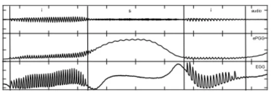 Fig.  4:  Extract  of  normalizations  of  ePGG  data  and  GA  during the production of [i] for the speaker 2 (blue line is the  ePGG data red line is GA from high-speed video-endoscopy  (2000 images/sec)