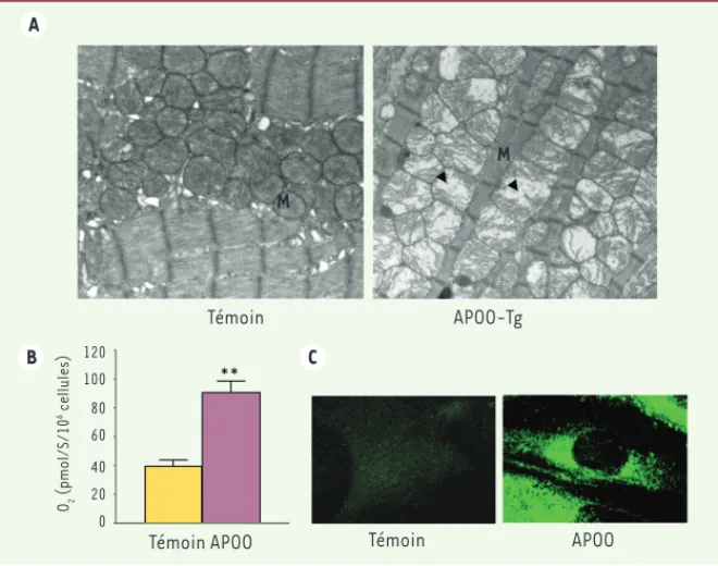 Figure 1. La surexpression de l’APOO altère la fonction mitochondriale et active la captation des  lipides par le cardiomyocyte