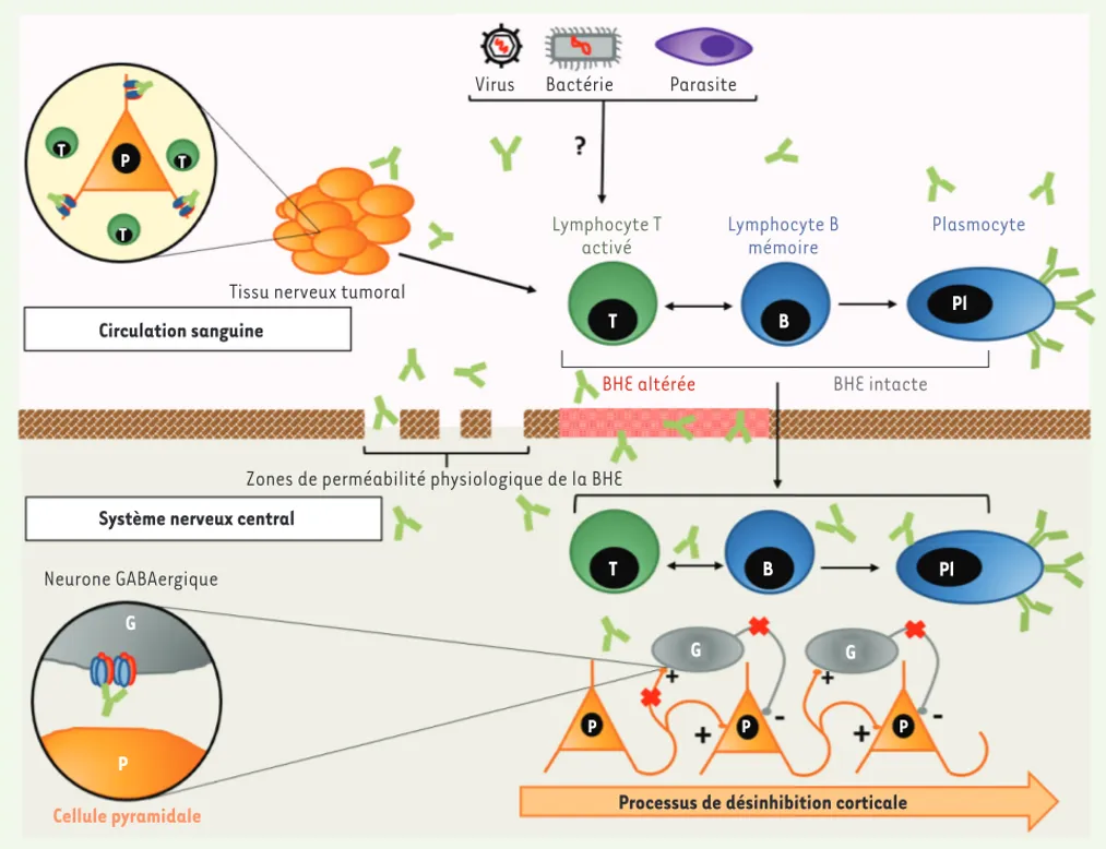 Figure 2. Physiopathologie des encéphalites anti-R-NMDA. Certains agents infectieux (virus, bactérie, parasite), par mimétisme moléculaire ou  libération d’antigènes lors de dégâts tissulaires, induisent une réaction auto-immune anti-R-NMDA