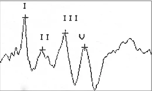 Figure  4  –  Normal  BAER  in  an  adult  cow  demonstrating  the  presence  of  4  waves