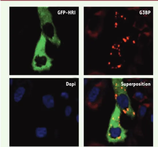 Figure 5. La surexpression de GFP-HRI induit la formation des granules de stress. 