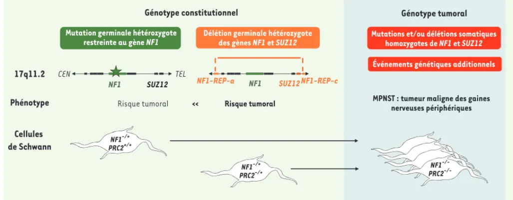Figure 1. Les pertes de fonction de NF1 et SUZ12 coopèrent dans la tumorigenèse des MPNST associés à la NF1