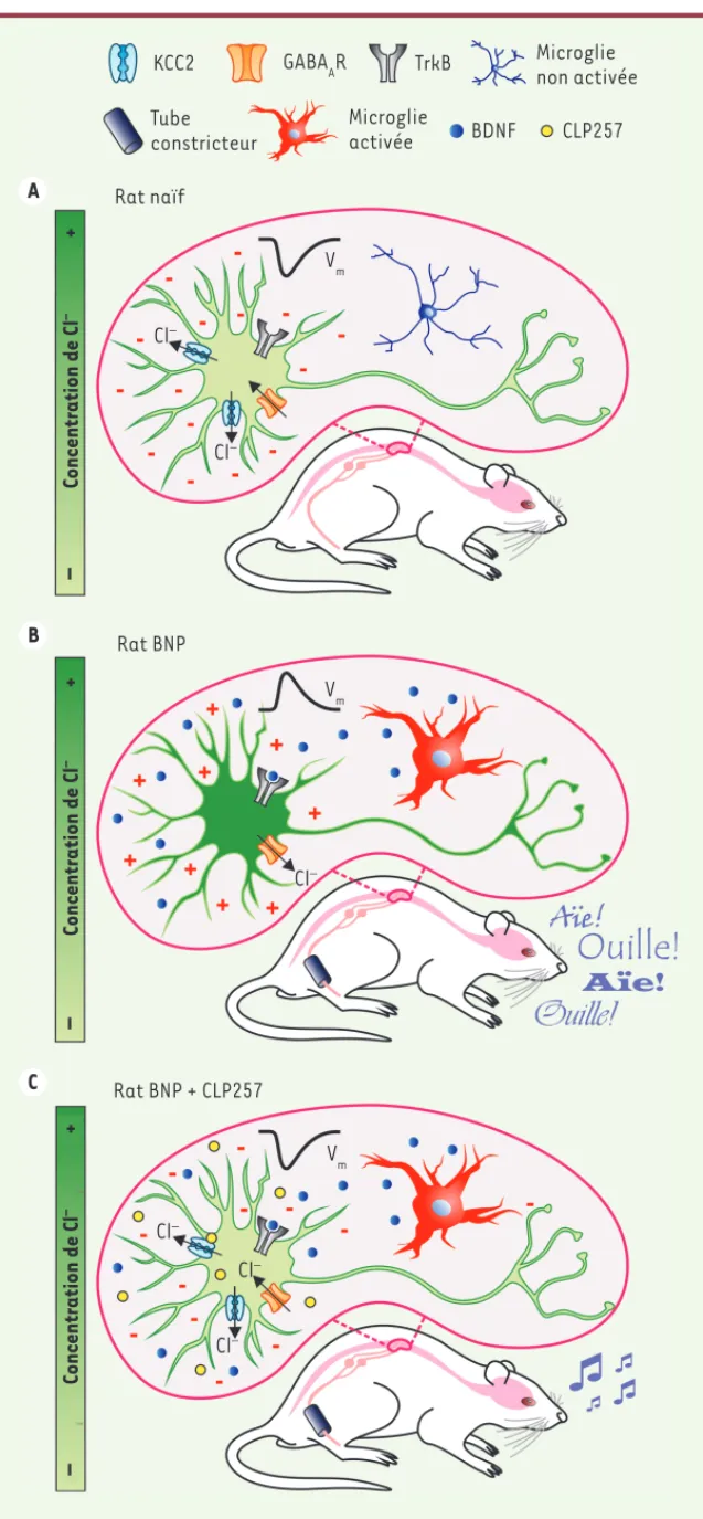 Figure 2.  Effet du CLP257 dans un modèle  animal de douleur chronique. A. En  condi-tion normale, la microglie est inactive et le  neurone possède des propriétés synaptiques  inhibitrices (-), une concentration  intra-cellulaire basse en Cl -  ([Cl - ] i 