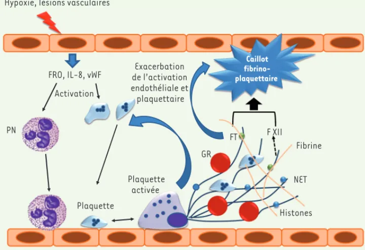 Figure 4. Rôle des NET au cours des thromboses veineuses profondes.  Les lésions de l’endothélium  vasculaire entraînent la libération de FRO, d’interleukine 8 (IL-8) et du facteur von Willebrand (vWF)  par les cellules endothéliales