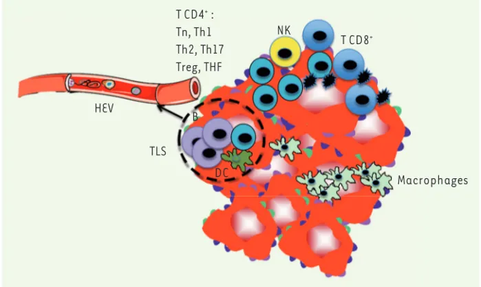 Figure 1. Le microenvironnement immuni- immuni-taire des tumeurs. Les tumeurs contiennent  tous les éléments du système  immuni-taire : lymphocytes (T, B, NK [natural  kil-ler]), cellules dendritiques, macrophages  et autres cellules myéloïdes) qui pénètre