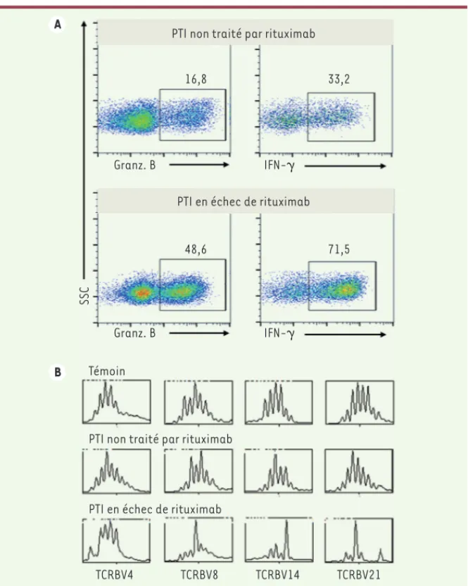 Figure 3. Anomalies des lymphocytes T CD8 +  spléniques chez les patients en échec de traitement  par rituximab