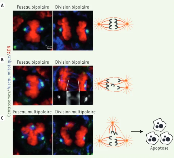 Figure 2. Conséquences de l’amplification centrosomale dans les cellules souches neuronales