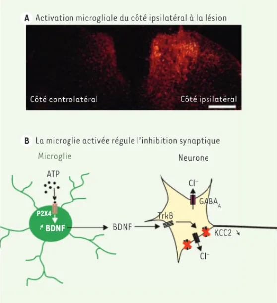 Figure 2.  Microglie et douleur neuropathique. A. Illustration de l’activation  microgliale dans la corne dorsale du côté ipsilatéral à la lésion périphérique