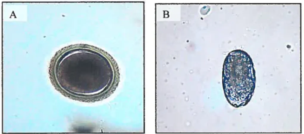 figure 5. Morphologie des oeufs de Toxocura spp. (A) et Ancylostorna caninum (3), telle que vue au microscope optique (400X)