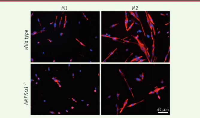 Figure 1. Rôle des macrophages sur la myogenèse in vitro. Le milieu conditionné de macrophages  normaux (WT) et déficients en AMPK1 (AMPKa1 -/- ) est déposé sur des myoblastes pendant 72 h