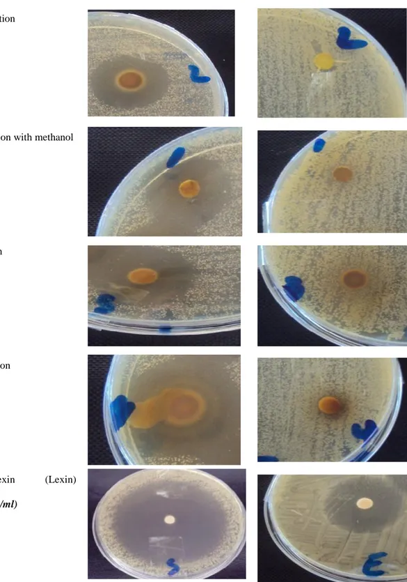 Table  4  .The  inhibitory  effect  of  extracts  of  plant  on  02  pathogenic  strains  (Staphylococcus aureus and Escherichia coli).