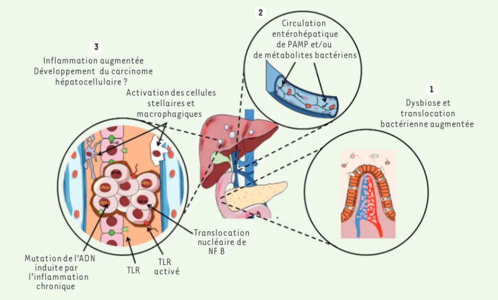 Figure 1. Communication foie/tube digestif dans le développement de la carcinogenèse hépatique