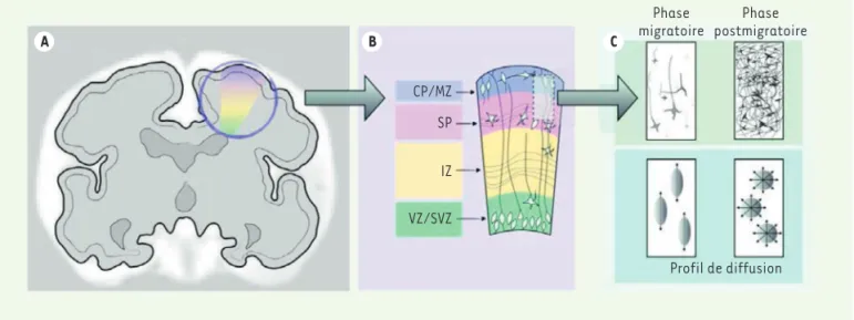 Figure 1. schéma du développement cortical. a. Vue coronale du cerveau fœtal. b. Représentation schématique du développement des couches  cérébrales