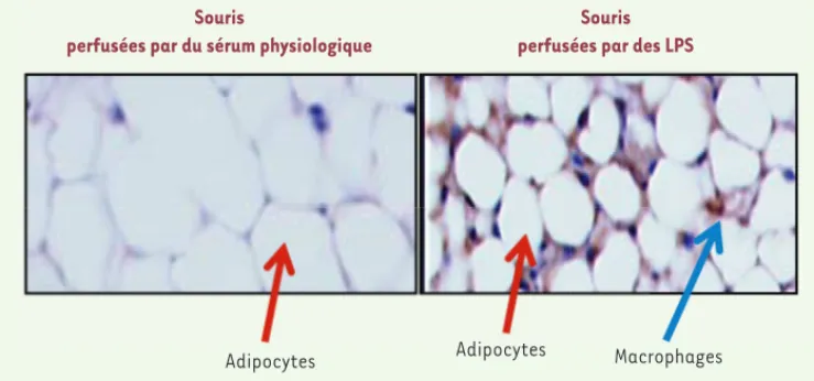 Figure 4. Infiltration  du tissu adipeux par des cellules immunitaires du tissu adipeux de souris perfusées par  des LPS