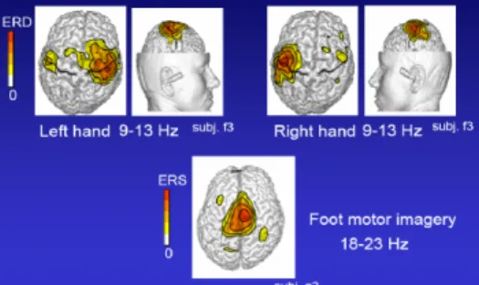 Fig. 11 Cerebral activity during the imagination of movements of the right hand and left hand 