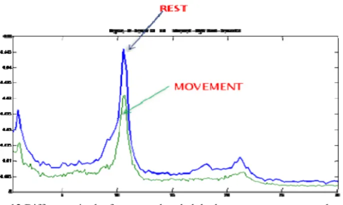 Fig. 12 Difference in the frequency band alpha between movement and rest 