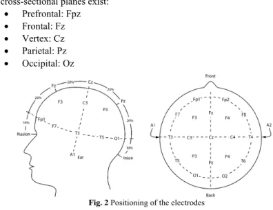 Fig. 2 Positioning of the electrodes 