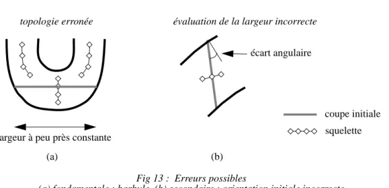 Fig 13 :  Erreurs possibles