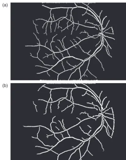 Fig. 7. Attribute images ﬁltered by the morphological path-opening operator ( i . The images have been calibrated for a better visualization.