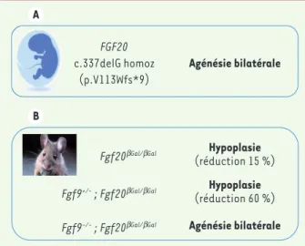 Figure 2. Phénotypes rénaux associés à la perte de FGF20 (homme) et à  la perte de Fgf9 et/ou Fgf20 (souris).