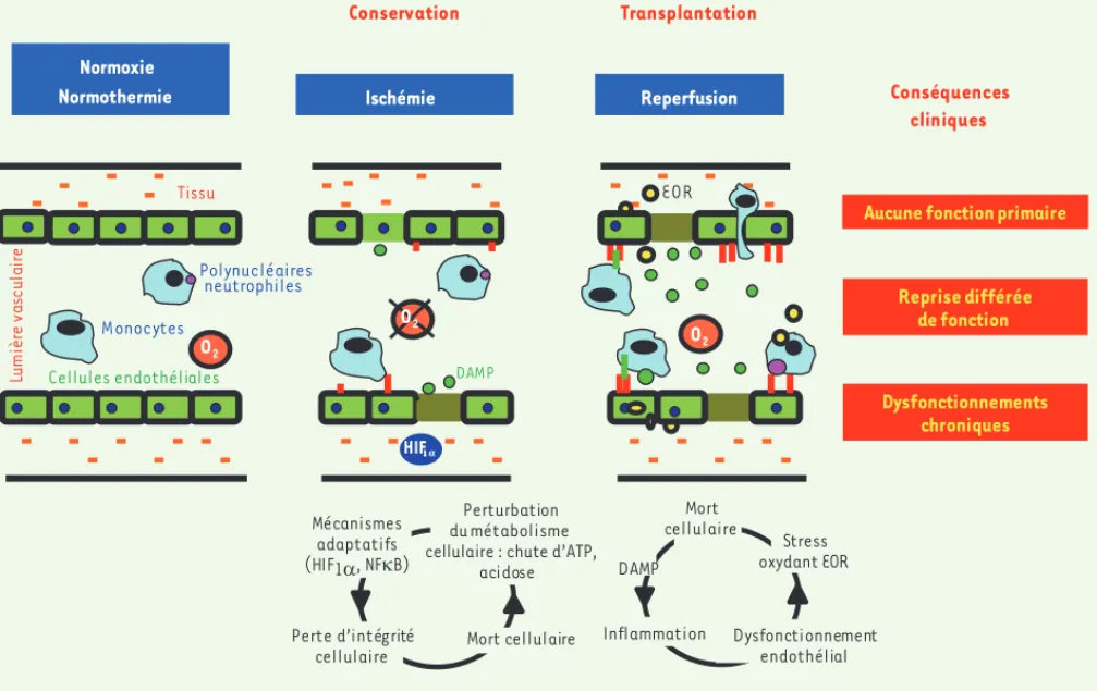 Figure 1. Ischémie reperfusion : principales conséquences cellulaires et cliniques en transplantation rénale