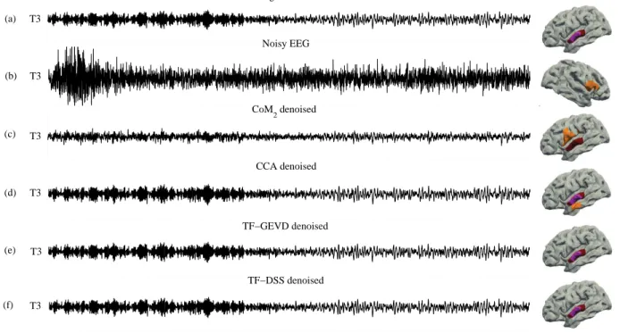 Fig. 3. Denoising results of one trial of simulated ictal data: (a) a noise free ictal EEG, (b) the noisy ictal EEG with the SNR value of −20dB, denoised signal by using (c) CoM 2 , (d) CCA, (e) TF-GEVD and (f) TF-DSS