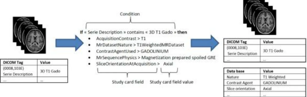 Figure 4: Example of a “StudyCardRule” for a 3D T1-Gd sequence
